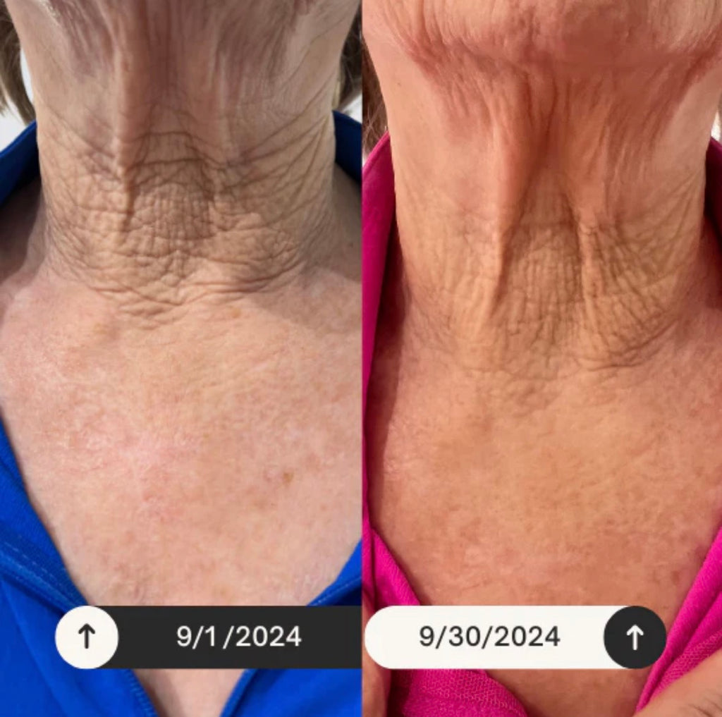 KrX Neck Lift Intensive Firming Neck Cream