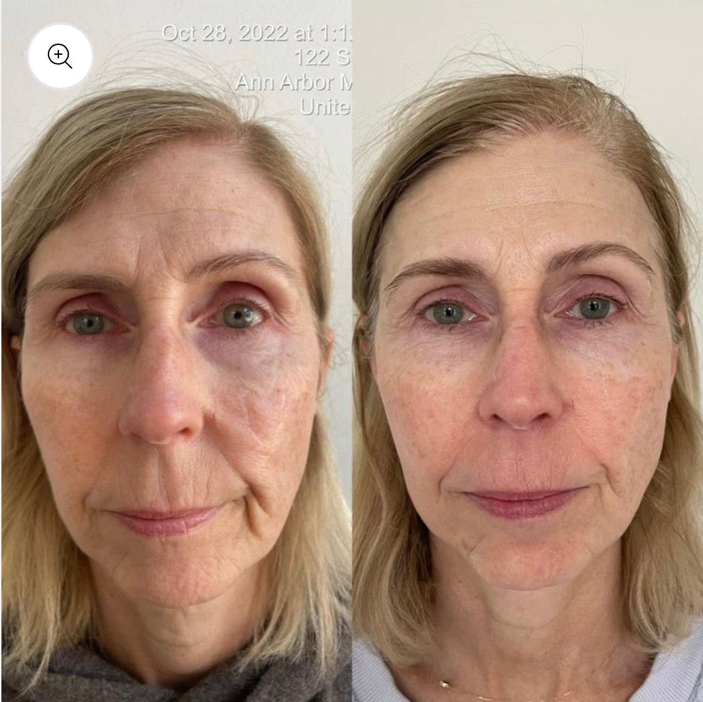 KrX The FaceLift Intensive Firming Serum
